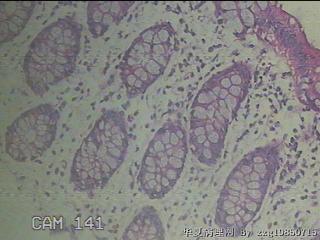 降乙结肠粘膜图13
