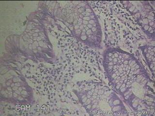 降乙结肠粘膜图29