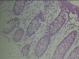 降乙结肠粘膜图14