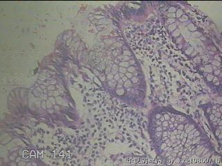降乙结肠粘膜图30