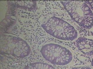 降乙结肠粘膜图28