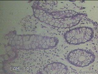 降乙结肠粘膜图21