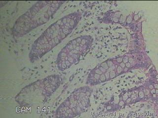 降乙结肠粘膜图17