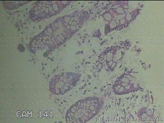 降乙结肠粘膜图19
