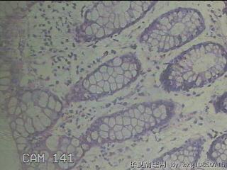 降乙结肠粘膜图23