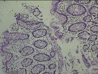 降乙结肠粘膜图1