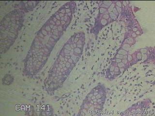 降乙结肠粘膜图15