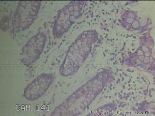 降乙结肠粘膜图16