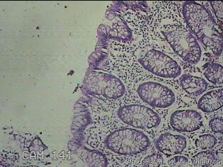 降乙结肠粘膜图4