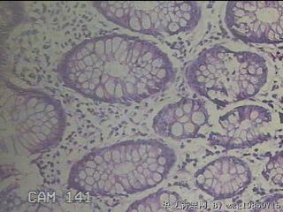 降乙结肠粘膜图27