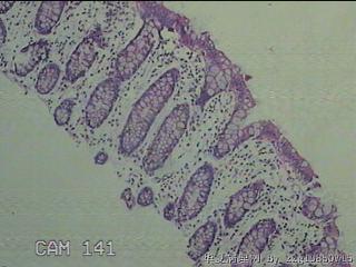 降乙结肠粘膜图7