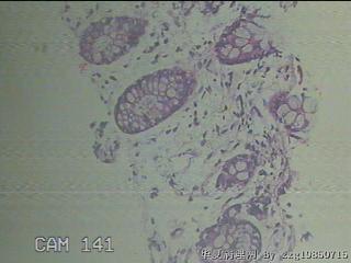 降乙结肠粘膜图20