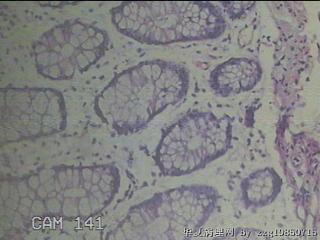 降乙结肠粘膜图22
