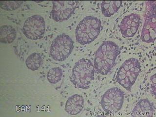 降乙结肠粘膜图11