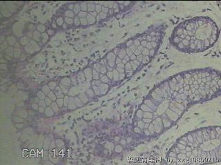 降乙结肠粘膜图24