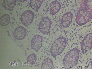降乙结肠粘膜图12