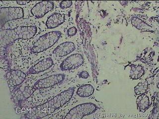 降乙结肠粘膜图2