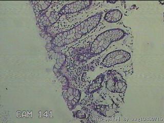 降乙结肠粘膜图3