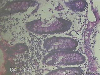 横结肠粘膜图23