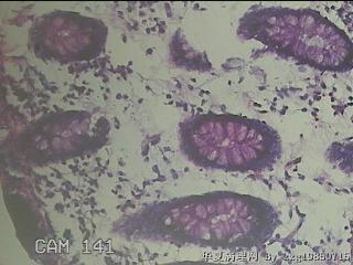 横结肠粘膜图22