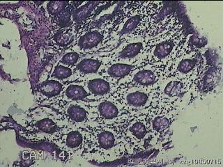 横结肠粘膜图4