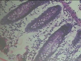 横结肠粘膜图3