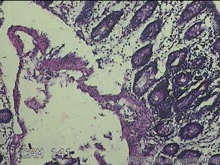 横结肠粘膜图5