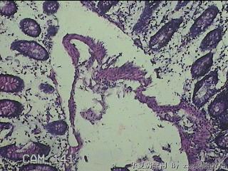 横结肠粘膜图9