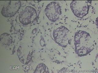 横结肠粘膜图12