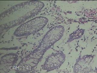 横结肠粘膜图22