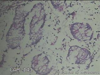 横结肠粘膜图23