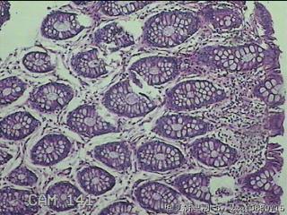 直肠粘膜图16