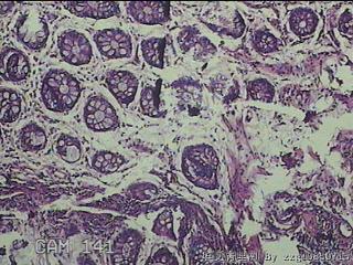 直肠粘膜图32