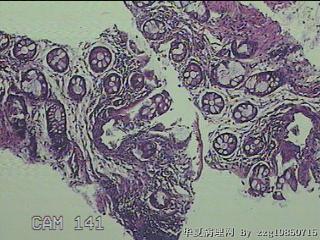直肠粘膜图9