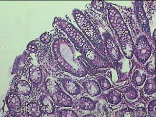 直肠粘膜图13
