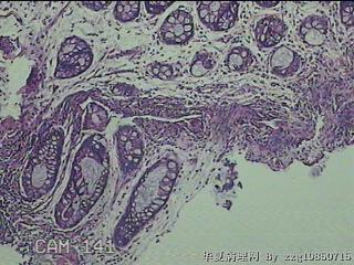 直肠粘膜图2