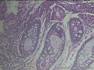 直肠粘膜图36