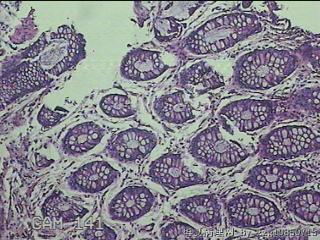 直肠粘膜图20