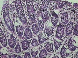 直肠粘膜图30