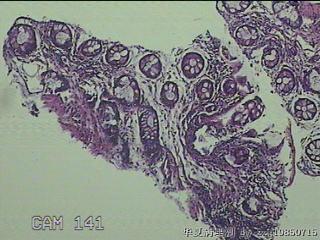 直肠粘膜图10