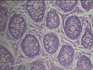 直肠粘膜图49