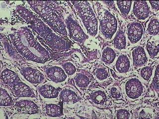 直肠粘膜图31