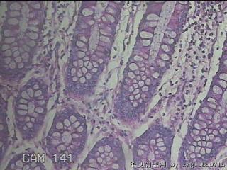 直肠粘膜图39