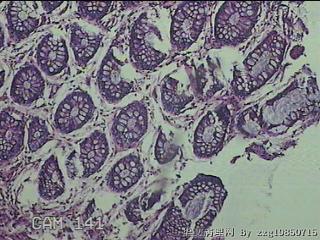 直肠粘膜图26