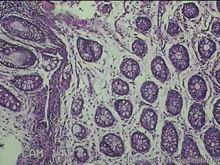 直肠粘膜图22