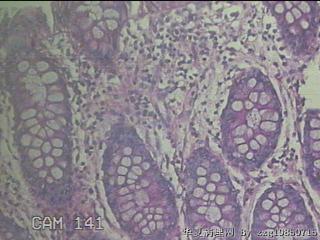 直肠粘膜图47