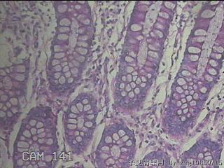 直肠粘膜图48
