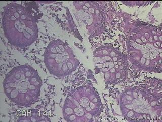 肝曲粘膜图18
