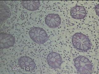 远端横结肠粘膜图29