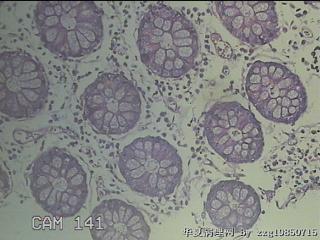 远端横结肠粘膜图24